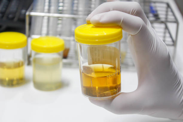 Urine sample